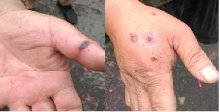 北京最新疫情動態(tài)與巷弄深處的獨(dú)特風(fēng)味