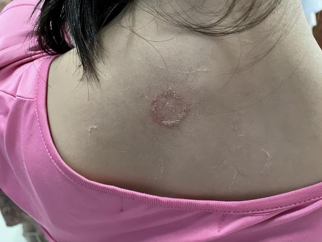 尤卓爾軟膏價格大解密，重磅揭秘真實(shí)價格??