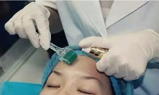 果酸換膚成本與代價(jià)揭秘，美麗背后的價(jià)格標(biāo)簽