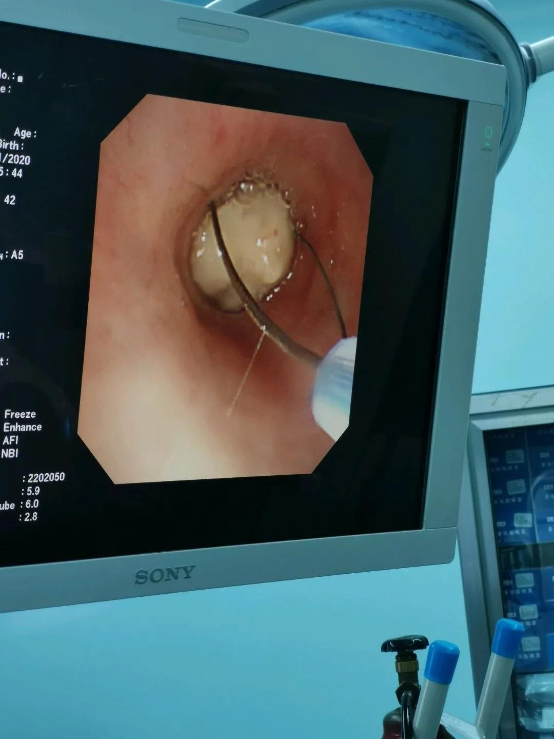 電子鼻咽喉鏡價格的市場定位分析，多元因素下的市場趨勢探討