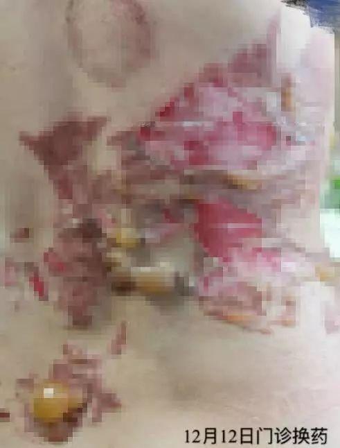 小巷特色養(yǎng)生館，最新拔罐圖片分享