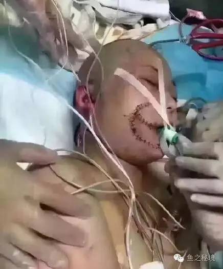 被虎咬的女子的最新消息，日常中的奇遇時(shí)刻